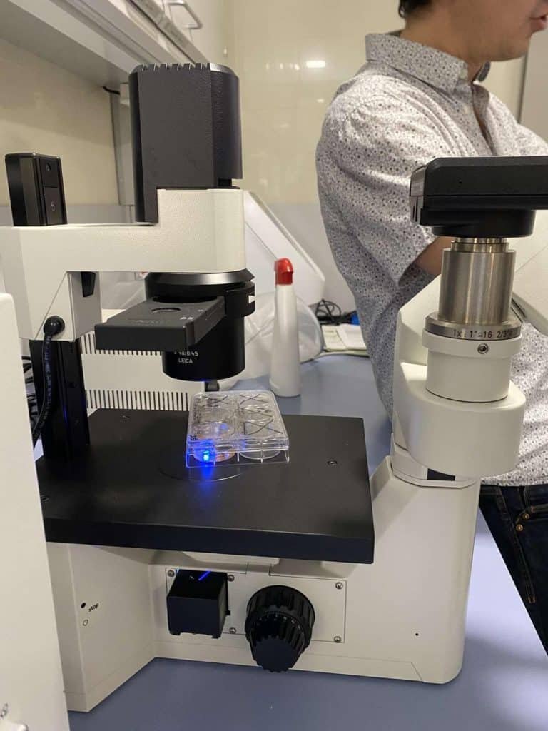 CSM : une plongée inspirante dans la recherche contre les tumeurs cérébrales 11 CSM une plongee inspirante dans la recherche contre les tumeurs cerebrales 12
