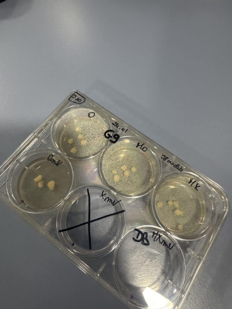CSM : une plongée inspirante dans la recherche contre les tumeurs cérébrales 4 CSM une plongee inspirante dans la recherche contre les tumeurs cerebrales 5