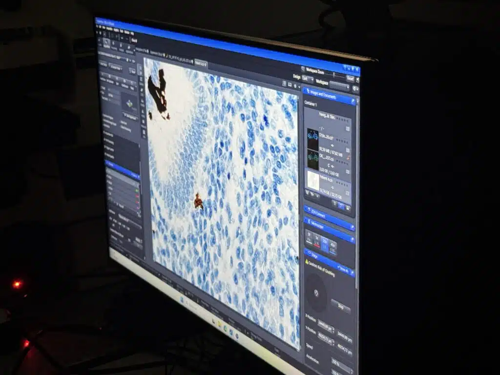 Un nouvel elan pour la recherche pediatrique a Monaco 5